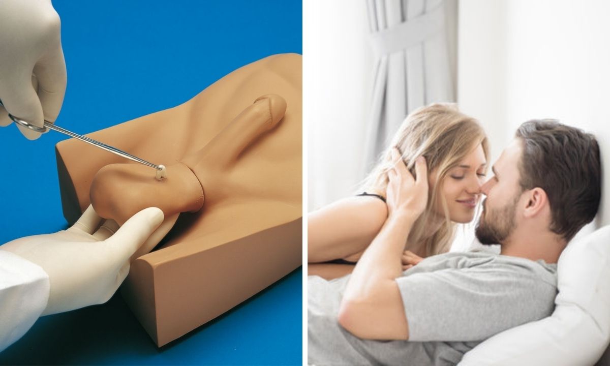 Sex po vazektómii: Všetko, čo potrebujete vedieť pre spokojný intímny život